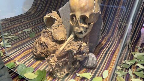 American Pediatrician Examines The Enigmatic Huayqui Mummy Of Ancient Peru
