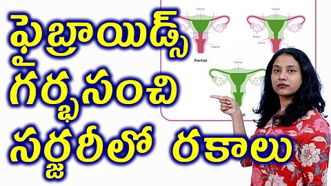 ఫైబ్రాయిడ్స్ గర్భసంచి సర్జరీలో రకాలు Types of Hysterectomy or Uterus Removal Fibroids Surgery