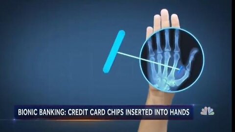 They Said It Was Nothing... Now Look What Happened!