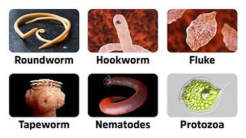 "Detecting Hidden Threats: 9 Crucial Warning Signs of Parasites, by Dr. Eric Berg"