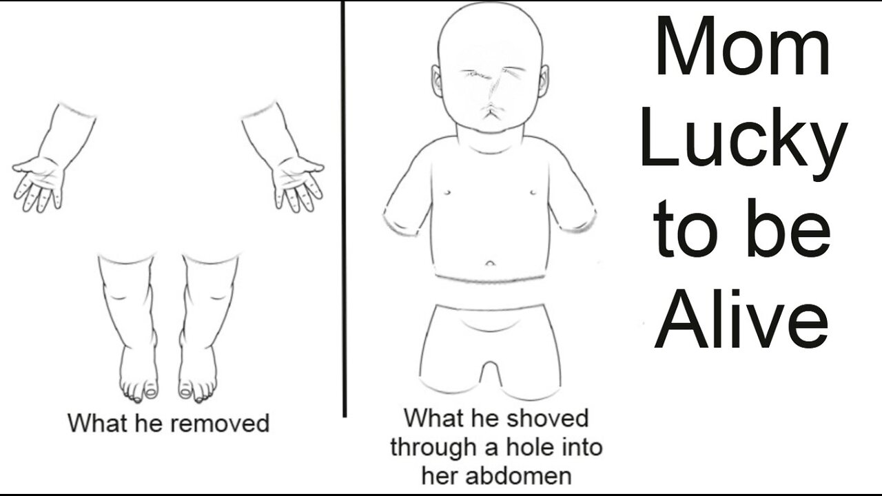 Mom Lucky to Be Alive