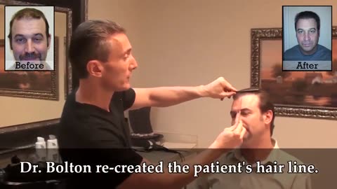 Great Hair Transplants: Dr. Brett Bolton’s Corrective Restoration
