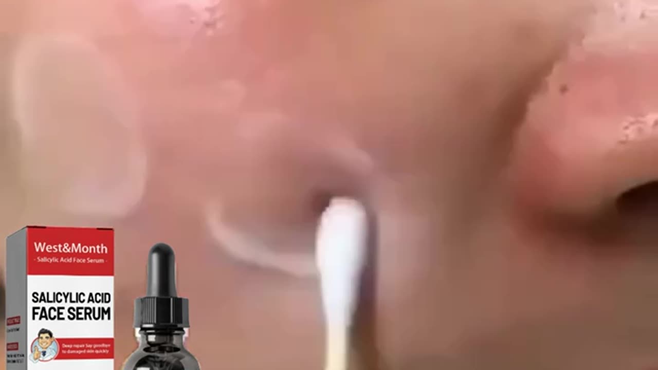 Powerful Spot-removing Whiten Facial Serum Niacinamide Salicylic Acid