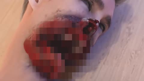 Chewing Gum Explosion Kills Student 😨
