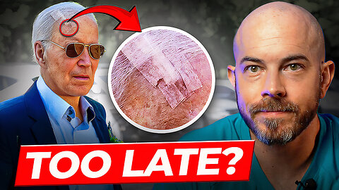 Joe Biden's Skin Cancer Diagnosis Explained