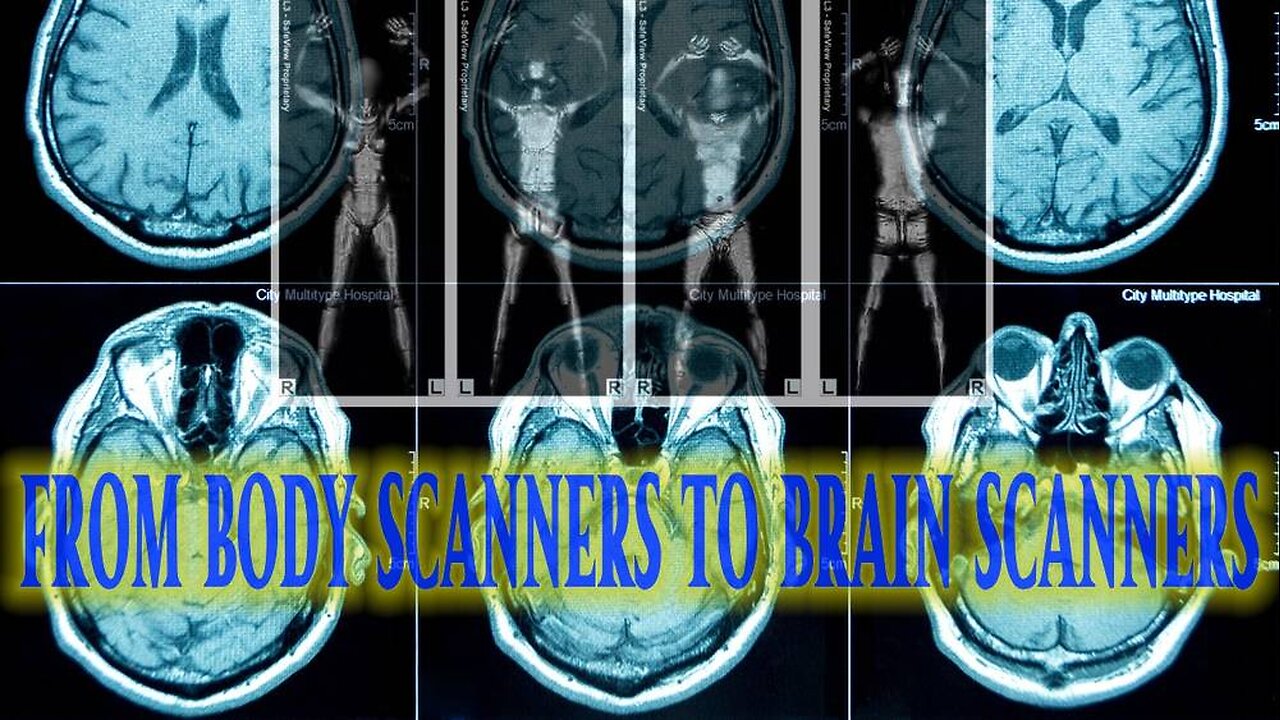 Obama TSA Not Satisfied With Body Scan, Wanted BRAIN SCANS Too!