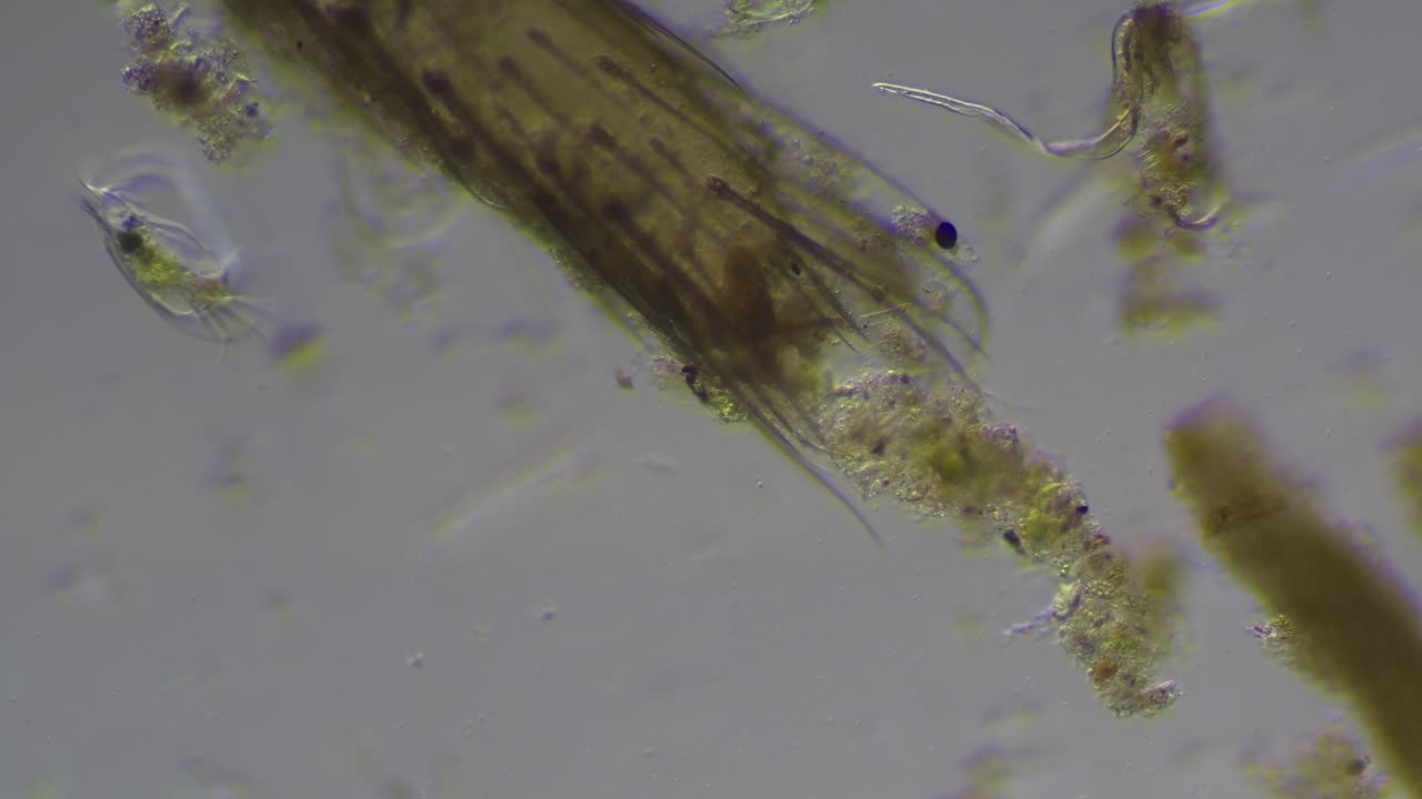 Ditch Water Microorganisms