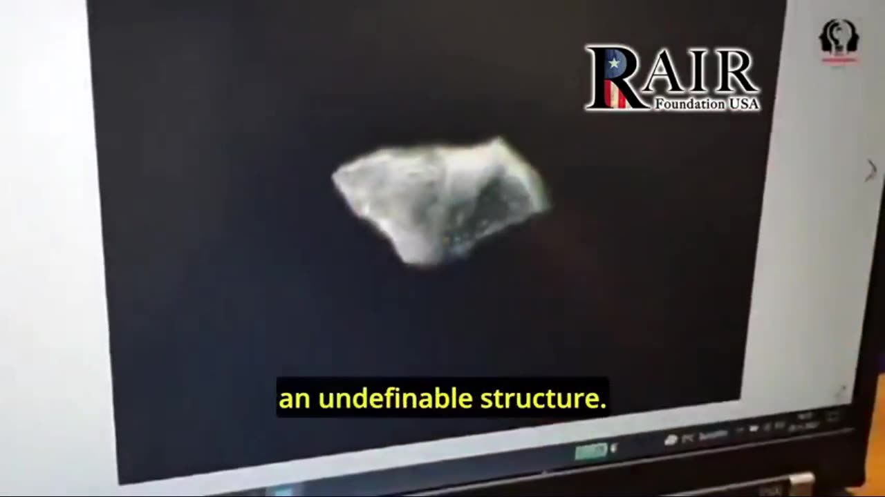 German Doctors find Astonishing Impurities in Covid Vaccine