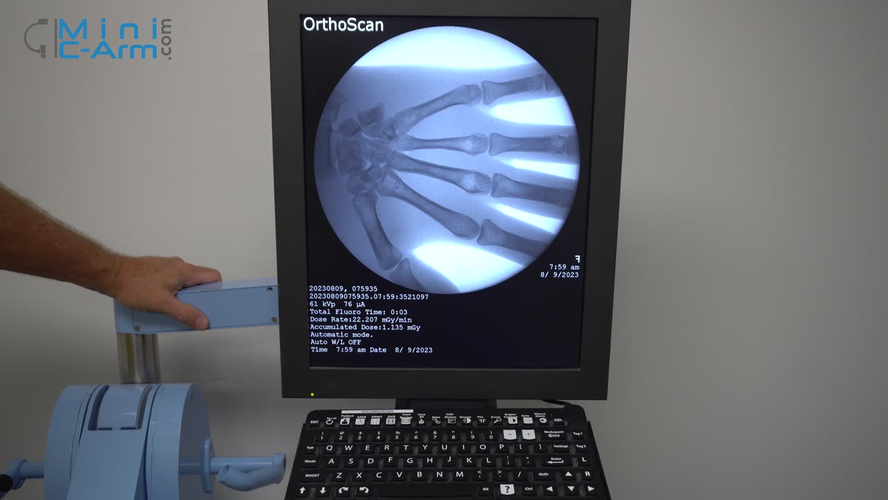 Orthoscan UC Mini C Arm Operational Walkthrough | Minicarm.com