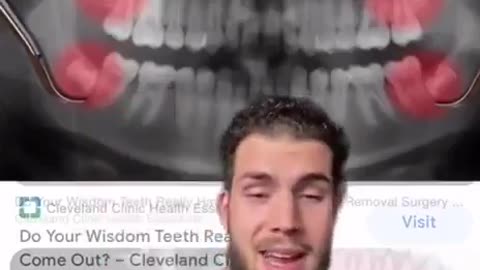 Guy drops a truth bomb about wisdom teeth