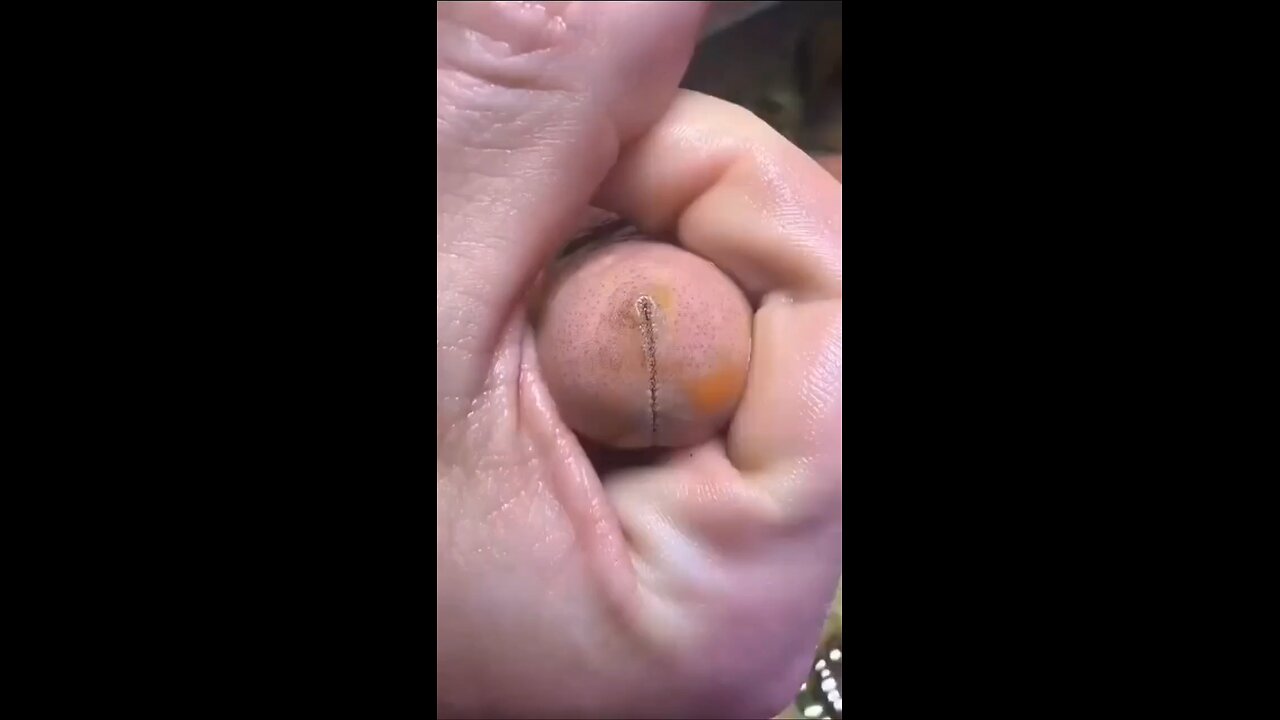 Dick