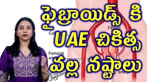 ఫైబ్రాయిడ్స్ కి UAE వల్ల నష్టాలు Risks of Uterine Artery Embolization UAE or Fibroid Artery Blocking