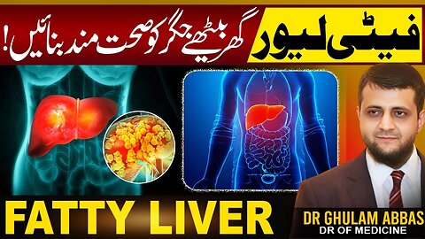 Fatty liver causes and Treatment
