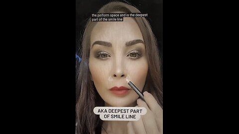 Piriform Fossa Filler Injection Technique Treatment Soon 💗💗💗