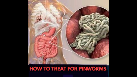 How to treat for Pinworms