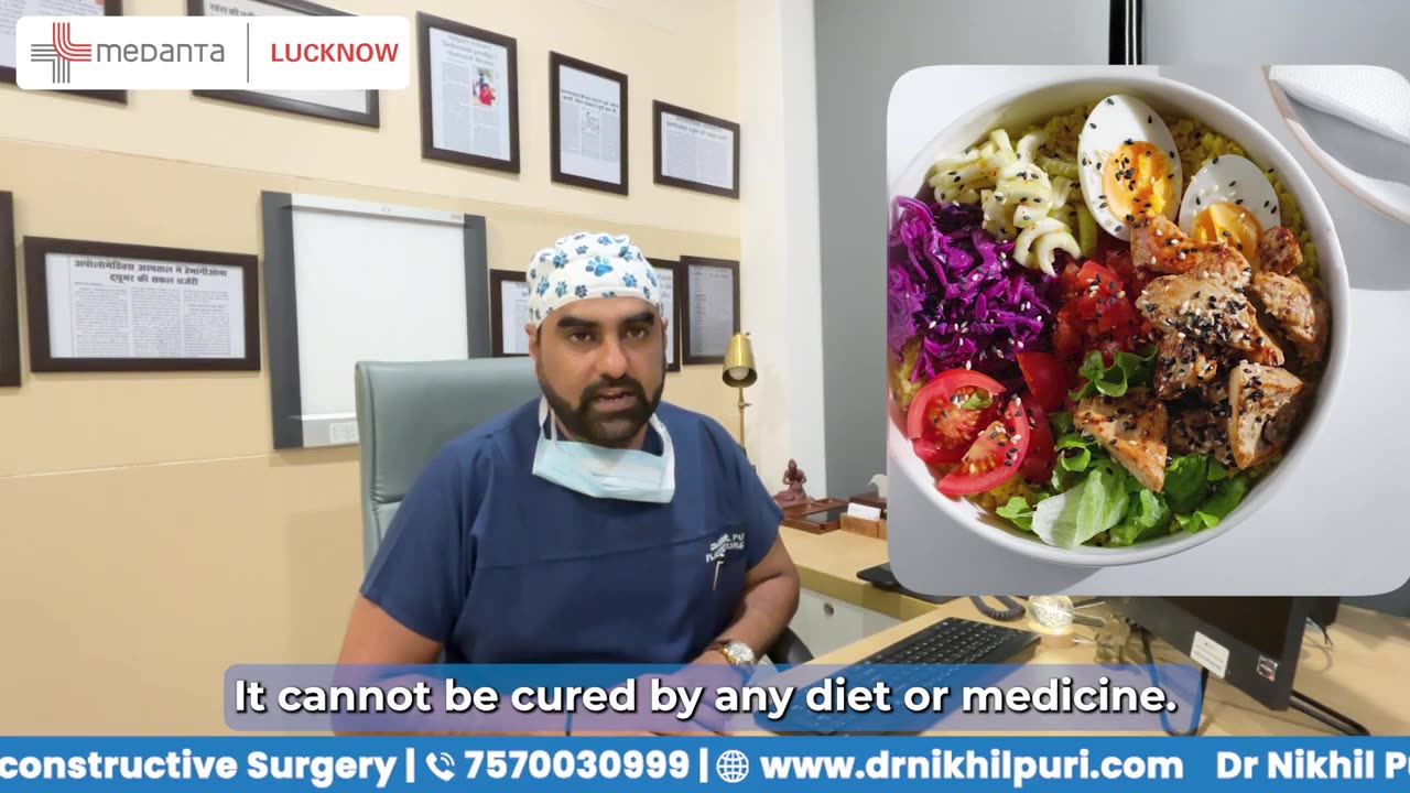 Best hair transplant in Lucknow - Dr.NikhilPuri