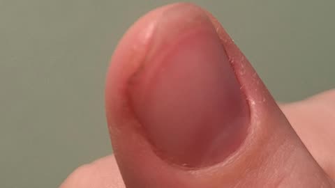 🤯👀 Watch A Cut Heal Before Your Eyes! | FeedMyCuriosity