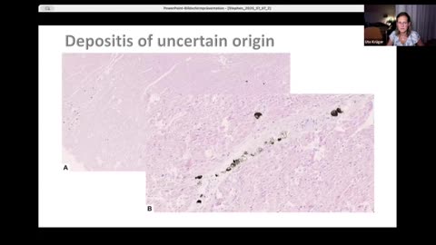 Evidence of Vaccine Harm: Presentation by Pathologist Dr Ute Krüger