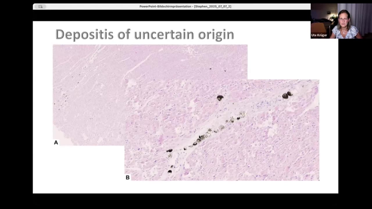 Evidence of Vaccine Harm: Presentation by Pathologist Dr Ute Krüger