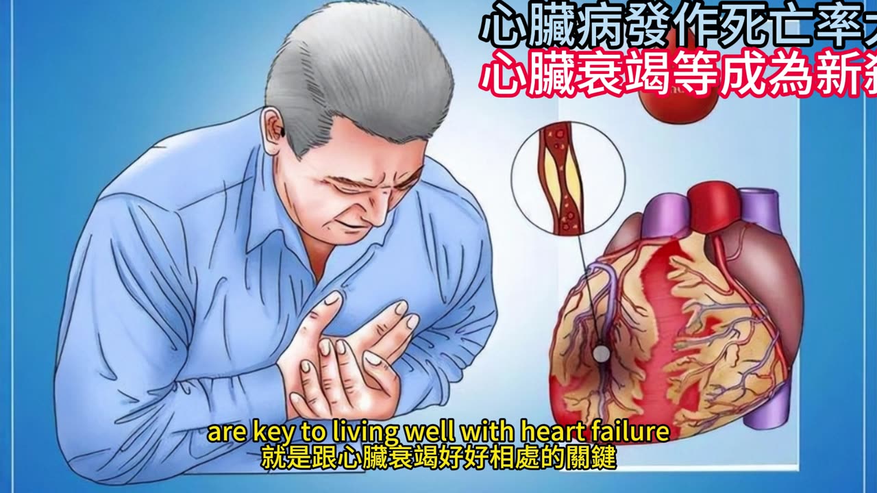 心臟病發作死亡率大降 心臟衰竭等成為新殺手