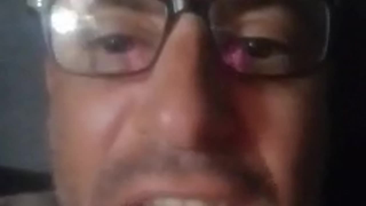 Its every video....