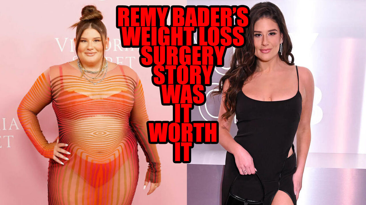 Remy Bader "Comes Clean" About Her Weight Loss Surgery | Was It Worth It?