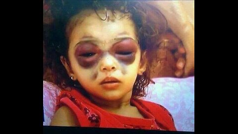 28 JULY - TWO-FACE LIAR PEDO TRUMP MUST BE IMPEACHED FOR GENOCIDE!!