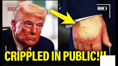 🚨Trump is TERRIFIED as Health Issues SURFACE IN PUBLIC
