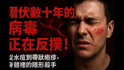 潛伏體內幾十年的惡魔！帶狀皰疹：從水痘變身的痛苦殺手 ｜ The Sleeping Demon in Your Body: How Chickenpox Turns into Shingles