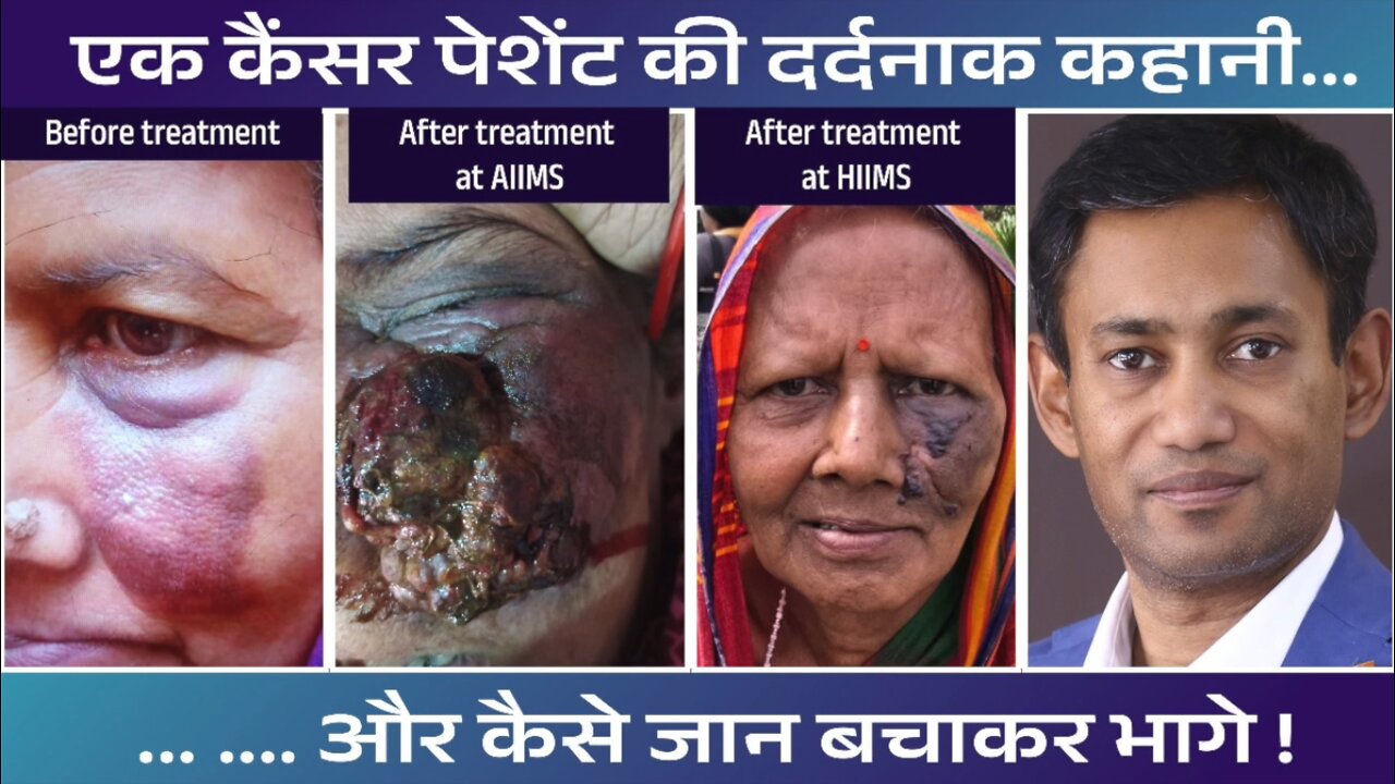 एक कैंसर पेशेंट की दर्दनाक कहानी