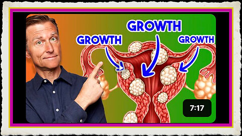 Over 50% of Women Have THIS !