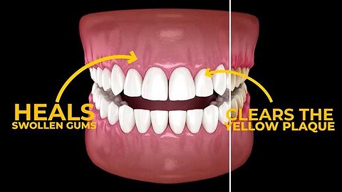Rebuild Your Teeth TWICE AS FAST with THIS Banned Himalayan Herbal Mix
