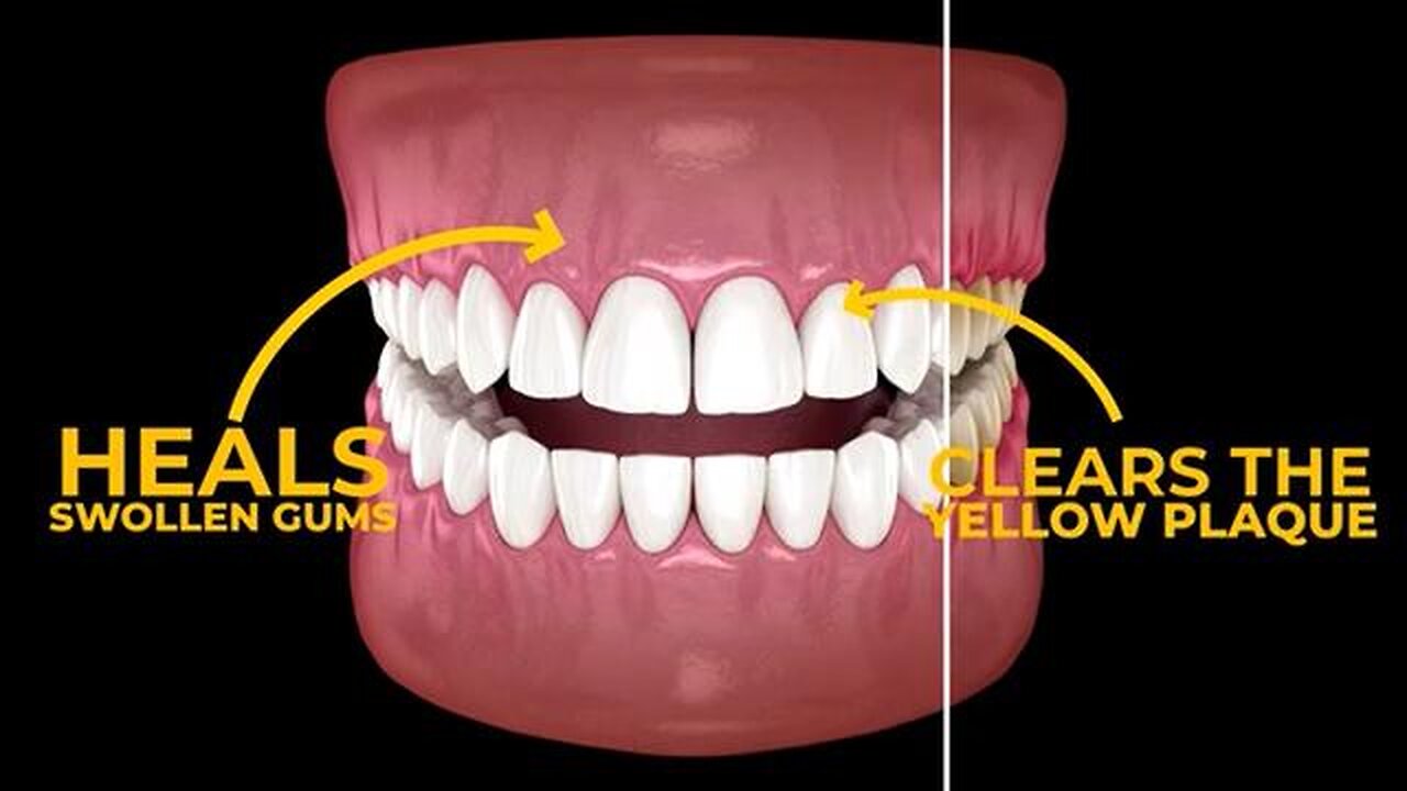 Rebuild Your Teeth TWICE AS FAST with THIS Banned Himalayan Herbal Mix