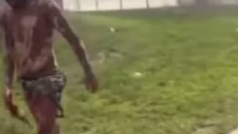 Hero Saves Kids from Firework Blast, Suffers Severe Burns to 80% of Body in Daring Apartment Rescue