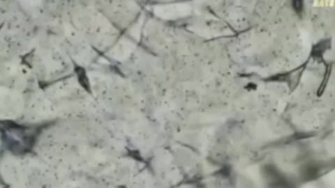Microscope reveals graphene fibers being placed into tampons.