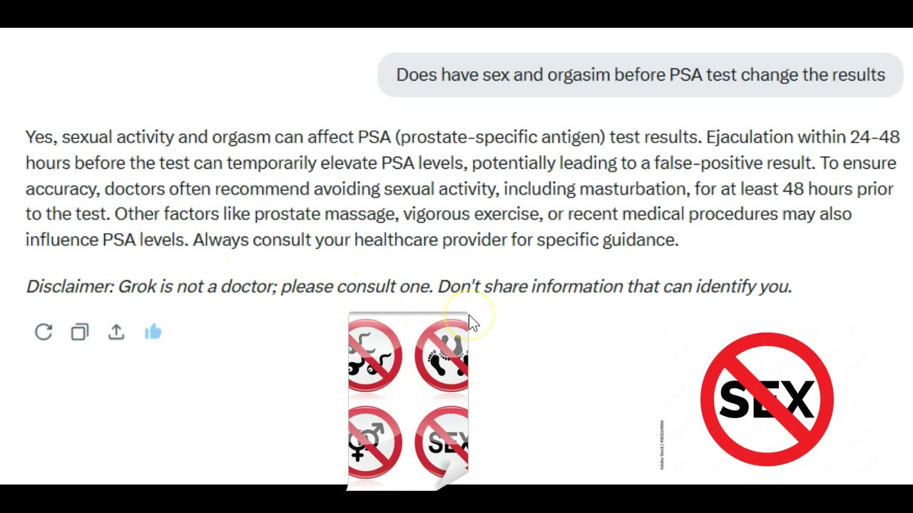 Important Pro Tip To Pass Your PSA Test - Who Knew