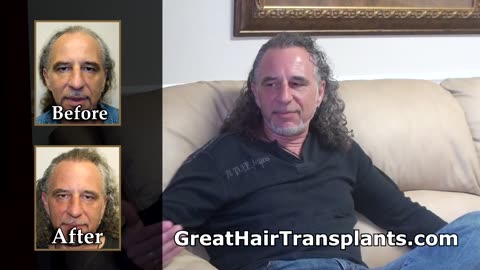 Hair Stylist Restores His Hair with Dr. Brett Bolton’s MaxHarvest™ Procedure