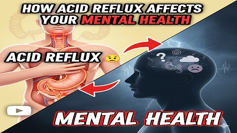 How Acid Reflux Affects Your Mental Health
