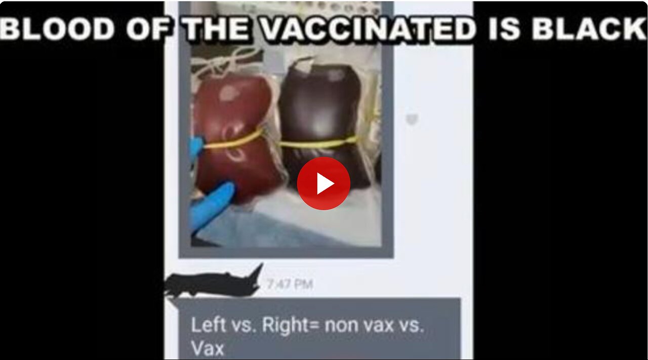 Why is the blood of the vaxed so dark? Black Blood? Who is really playing Joe Biden behind the mask?