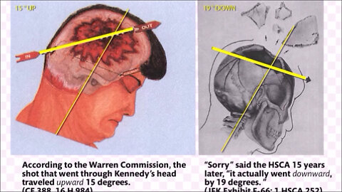 "Burning Down The House" -HSCA Fine-Tunes Coverup- Gill Jesus Pt5 Frontal Shot Evidence: Conclusion