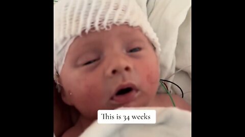 Heartbreaking Setback: New Late-Term Abortion Clinics In Colorado And New Jersey Spark Outrage