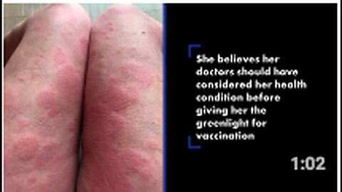 "UK Woman Claims AstraZeneca COVID-19 Vaccine Transformed Her into 'Alien' Monster"