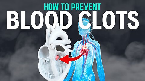 Blood Clot Prevention: Easy Steps for Better Health and Wellness |06