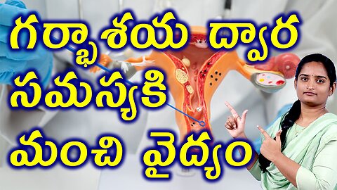 గర్భాశయ ద్వార సమస్యకి మంచి వైద్యం Best Treatment For Cervical Infection