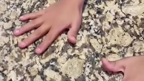 MY SON HAS 11 FINGERS!!