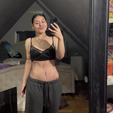 An amazing weight loss