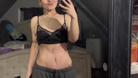 An amazing weight loss