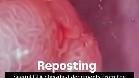💥💥💥 Evidence that Tumors are Parasites