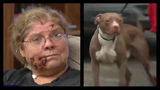It's Time To BAN Pit Bulls