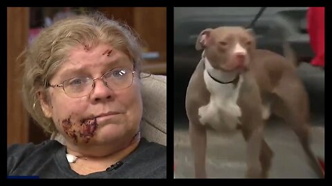 It's Time To BAN Pit Bulls